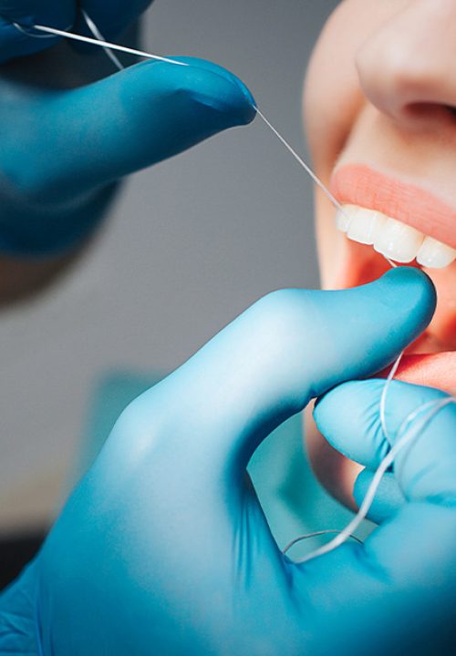 igiene-prevenzione-dentale